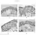 Fig. 09 - Methods and compositions for treating atopic dermatitis