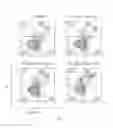 Fig. 05 - All-trans retinoic acid injectant and application