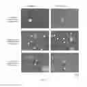 Fig. 09 - All-trans retinoic acid injectant and application