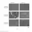 Fig. 10 - All-trans retinoic acid injectant and application