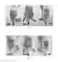 Fig. 13 - Method for preventing or treating diseases associated with the inhibition of EGFR