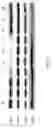 Fig. 18 - Predicting response to alvocidib by mitochondrial profiling