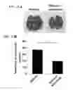Fig. 25 - Method for prevention or treatment of diabetic complications