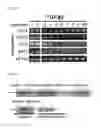 Fig. 28 - Nuclear paraspeckle assembly transcript 1 as therapeutic targeting in neurodegeneration
