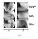 Fig. 04 - Compositions useful for mucosal healing