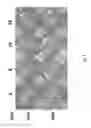 Fig. 04 - Ionizing irradiation sterilization of bacterial minicell-based biopharmaceuticals and methods of use