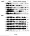 Fig. 47 - Uses and development of neurodefend for treating neurodegenerative diseases
