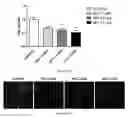 Fig. 69 - Uses and development of neurodefend for treating neurodegenerative diseases