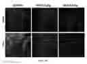Fig. 75 - Uses and development of neurodefend for treating neurodegenerative diseases