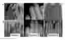 Fig. 01 - PHARMACEUTICAL COMPOSITION COMPRISING PURPLE CORN EXTRACT FOR PREVENTION OR TREATMENT OF SKIN DISEASE