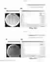 Fig. 09 - Antibacterial composition and a method of treating staphylococcal infections with the antibacterial composition