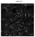 Fig. 03 - TREATMENT OF EYE DISEASE