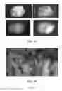 Fig. 02 - Methods of treating breast cancer
