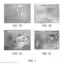 Fig. 03 - Methods of treating breast cancer