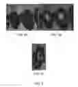 Fig. 06 - Methods of treating breast cancer