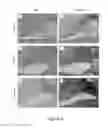 Fig. 04 - Compositions comprising relaxin and methods of use thereof