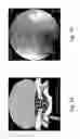 Fig. 02 - Compositions and methods for promoting the mineralization of biological tissue