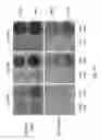 Fig. 11 - Compositions and methods for promoting the mineralization of biological tissue