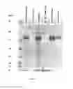 Fig. 02 - Virus like particle purification