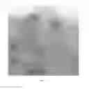 Fig. 08 - Virus like particle purification