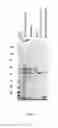 Fig. 16 - Virus like particle purification