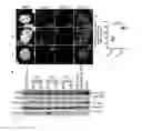 Fig. 07 - EBV vaccine