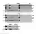 Fig. 10 - EBV vaccine