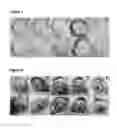 Fig. 05 - THIOLATED HYALURONAN-BASED HYDROGELS CROSS-LINKED USING OXIDIZED GLUTATHIONE