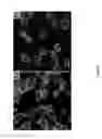 Fig. 06 - CONJUGATES OF HYALURONIC ACID AND ANTICANCER COMPOUNDS