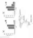 Fig. 07 - CONJUGATES OF HYALURONIC ACID AND ANTICANCER COMPOUNDS