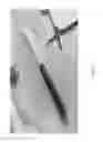 Fig. 02 - FOAMING ACTION PHARMACEUTICAL HEMOSTAT