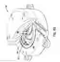 Fig. 09 - Conduit tips and systems and methods for use