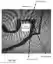 Fig. 100 - Conduit tips and systems and methods for use