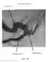 Fig. 101 - Conduit tips and systems and methods for use