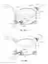 Fig. 34 - Conduit tips and systems and methods for use