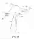 Fig. 42 - Conduit tips and systems and methods for use