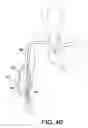 Fig. 57 - Conduit tips and systems and methods for use