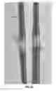 Fig. 68 - Conduit tips and systems and methods for use