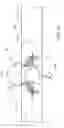 Fig. 98 - Conduit tips and systems and methods for use