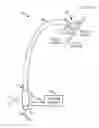 Fig. 01 - TRANSSEPTAL ACCESS DEVICE AND METHOD OF USES