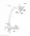 Fig. 02 - TRANSSEPTAL ACCESS DEVICE AND METHOD OF USES