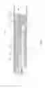 Fig. 03 - Drug Delivery Device