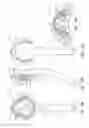 Fig. 03 - Laryngeal mask cuffs