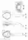 Fig. 06 - Laryngeal mask cuffs