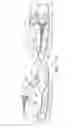 Fig. 13 - Laryngeal mask cuffs