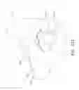 Fig. 15 - Laryngeal mask cuffs