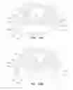 Fig. 18 - Laryngeal mask cuffs