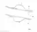Fig. 07 - Bendable tracheal ventilation apparatus