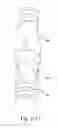 Fig. 18 - DELIVERY OF RESPIRATORY THERAPY
