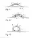 Fig. 23 - DELIVERY OF RESPIRATORY THERAPY
